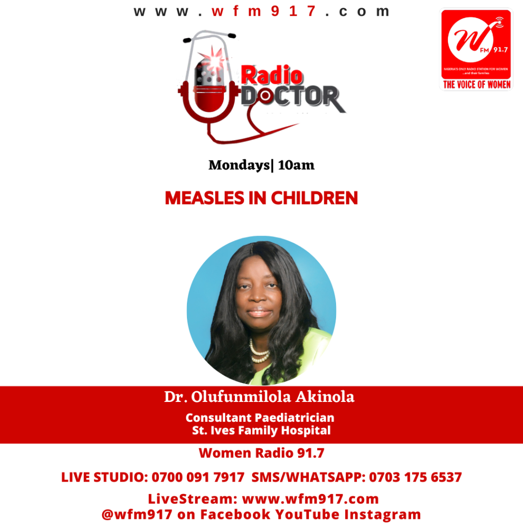 Measles in children